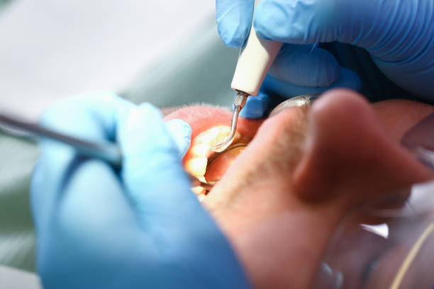 Best Emergency Broken Tooth Repair in Cut Off, LA